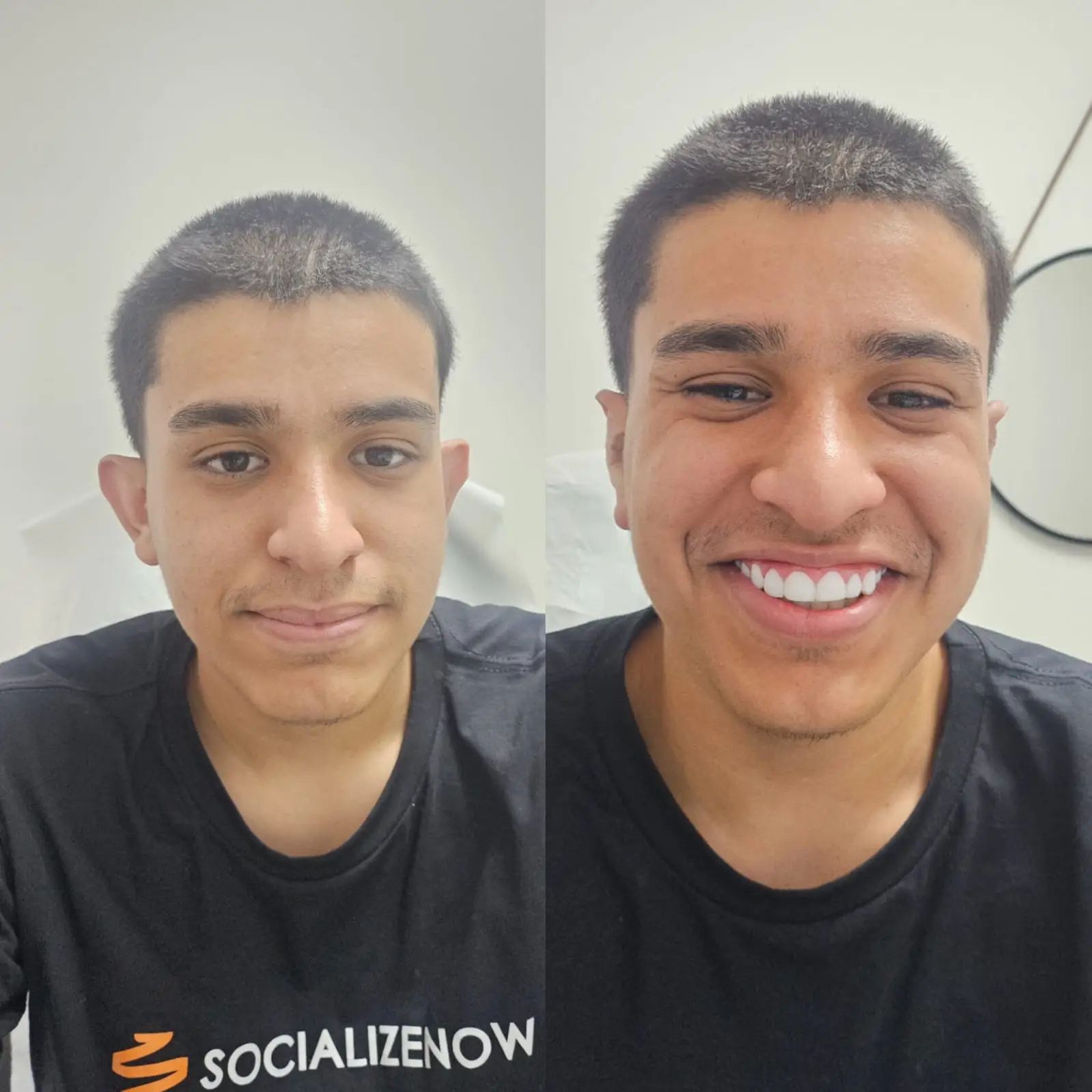 Otomodelação antes e depois 11