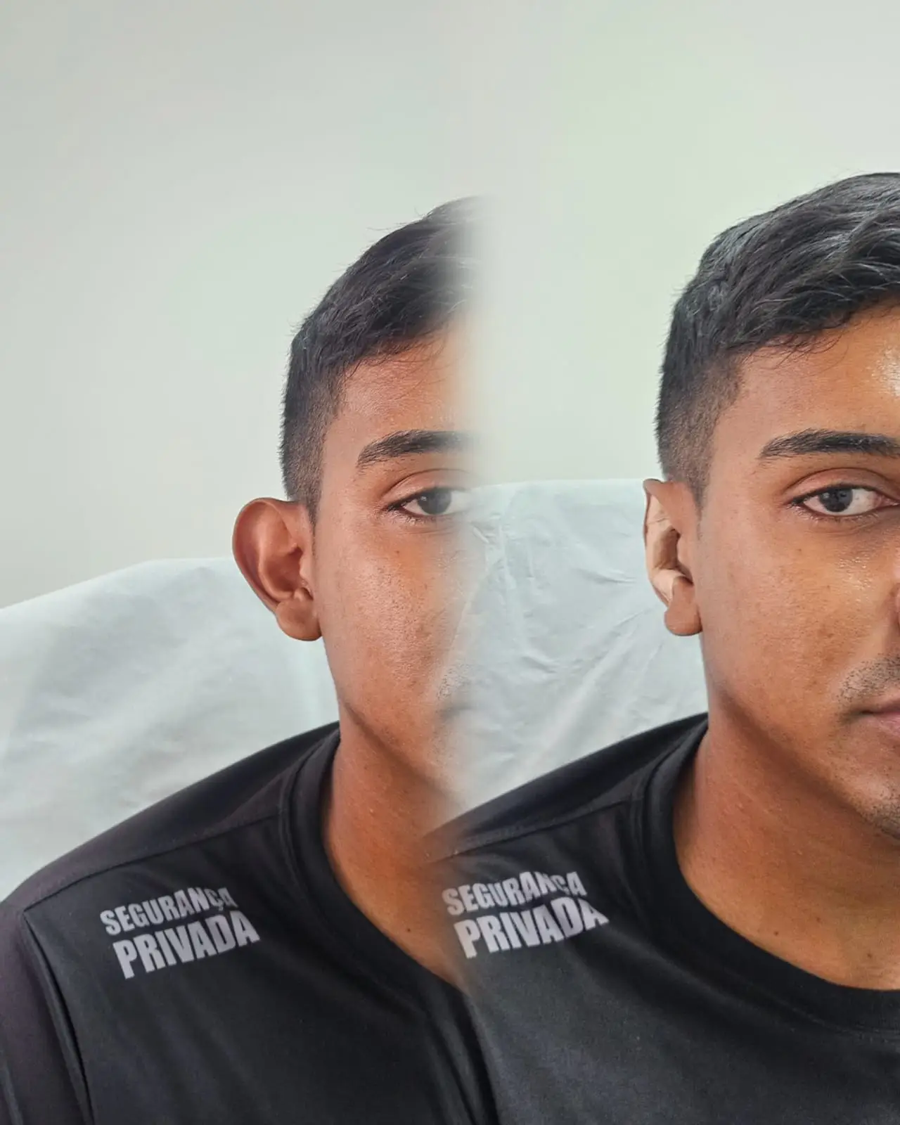 Otomodelação antes e depois 24