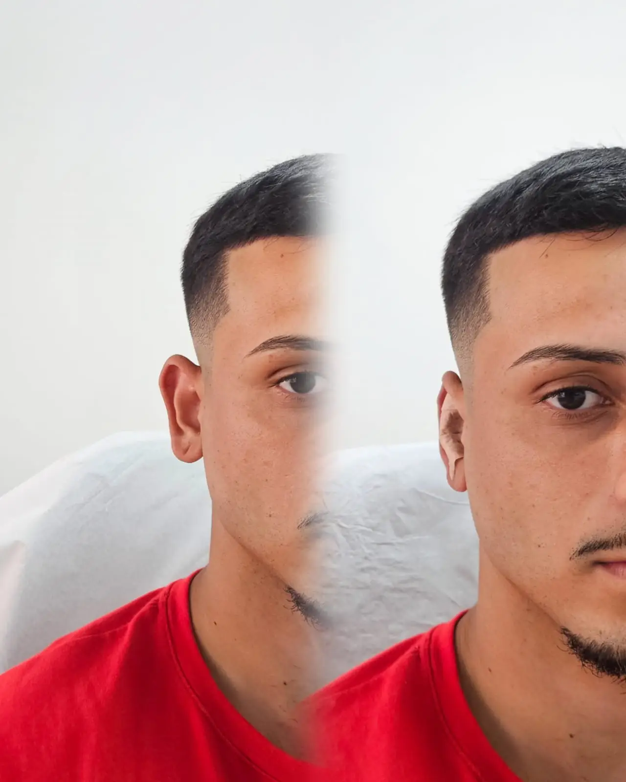 Otomodelação antes e depois 27